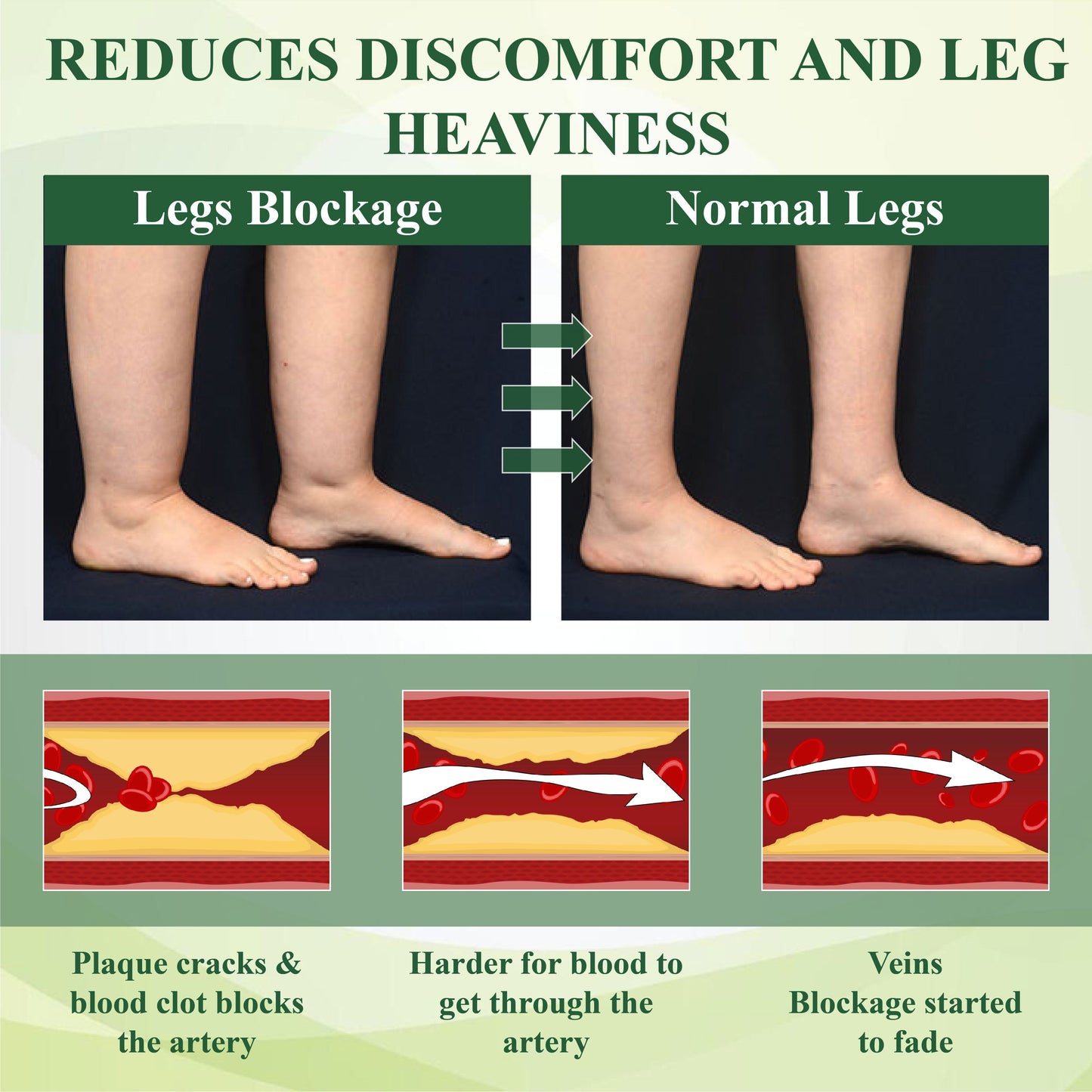 VascuRelief™ — Banish Swelling and Rediscover Effortless Freedom