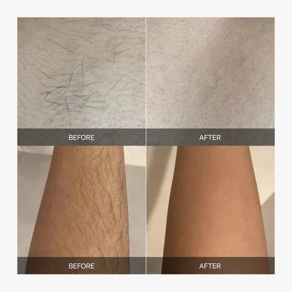 Veloura™ — Reveal Silky, Pain-Free Smoothness That Lasts and Empowers Your Glow