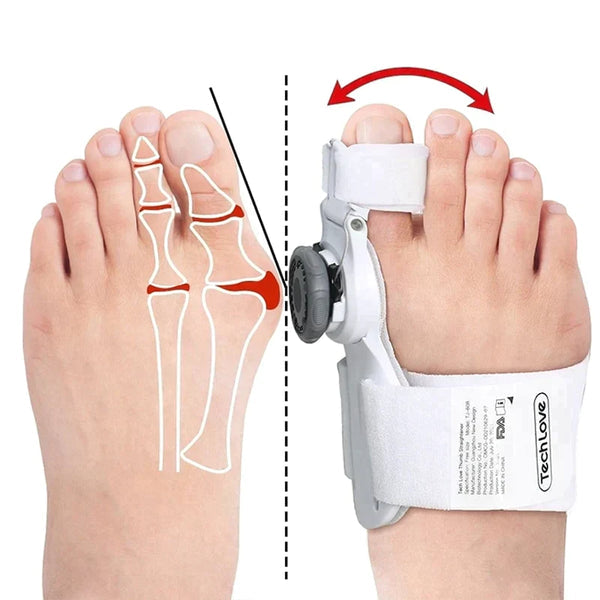 Alignix™ — Straighten Toes, End Bunion Pain Fast | 50% Off