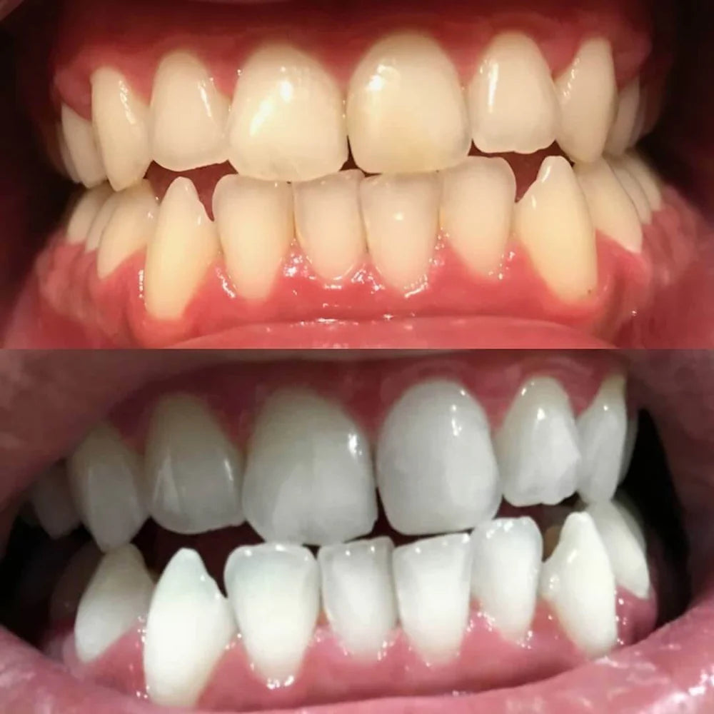 LumaShine™ — Unleash a Brilliant Smile That Commands Every Room