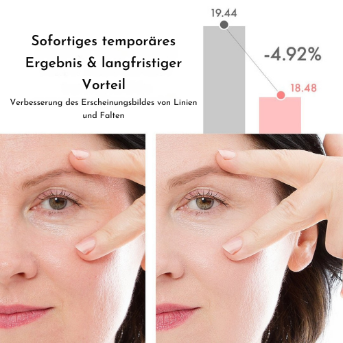 VioraLuxe™ Eye Renewal Stick — Reveal Youthful, Radiant Eyes That Captivate Instantly
