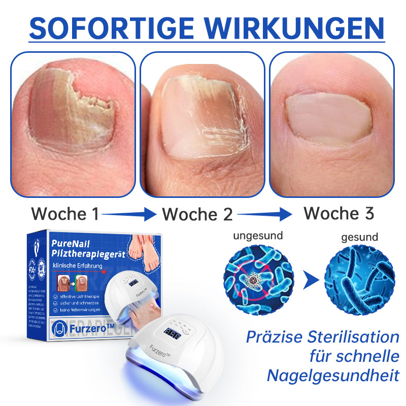 PureNail™ — Zap Nail Fungus Painlessly & Fast | 50% Off