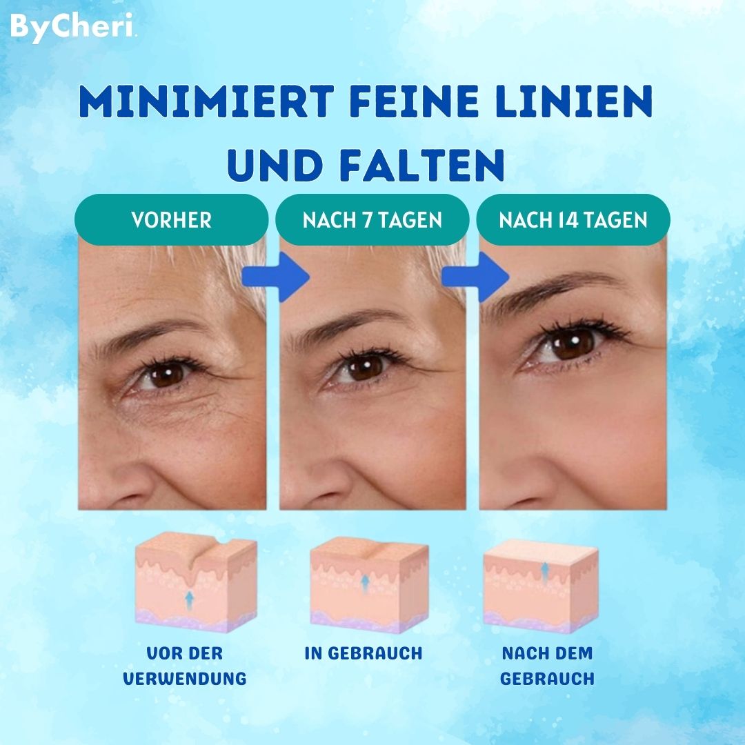 YouthGlow | Smooth Wrinkles Without Needles | 1+1 Free