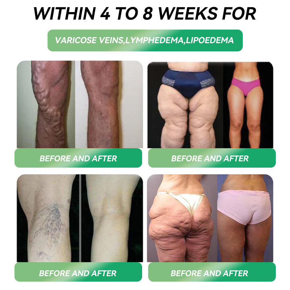 Officially Certified by the UK NHS Flagship Store Direct Sales | LERCEA® GLP-1 Metabolic Balance Oral Ampoules: Ideal for Obesity, Cardiovascular Diseases, Diabetes, Sleep Apnea Syndrome, Joint Problems, and More🌿