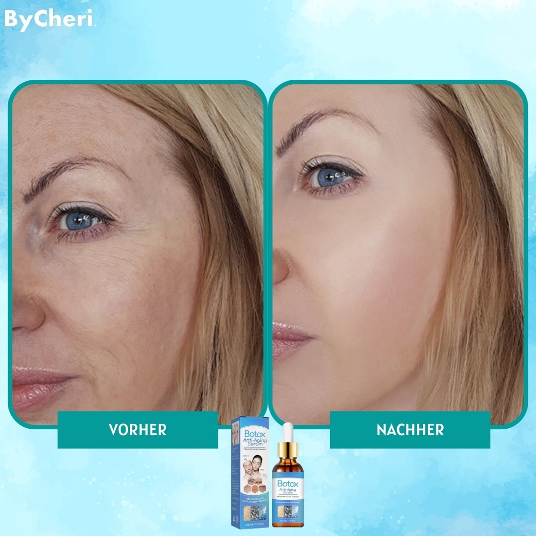 YouthGlow | Smooth Wrinkles Without Needles | 1+1 Free