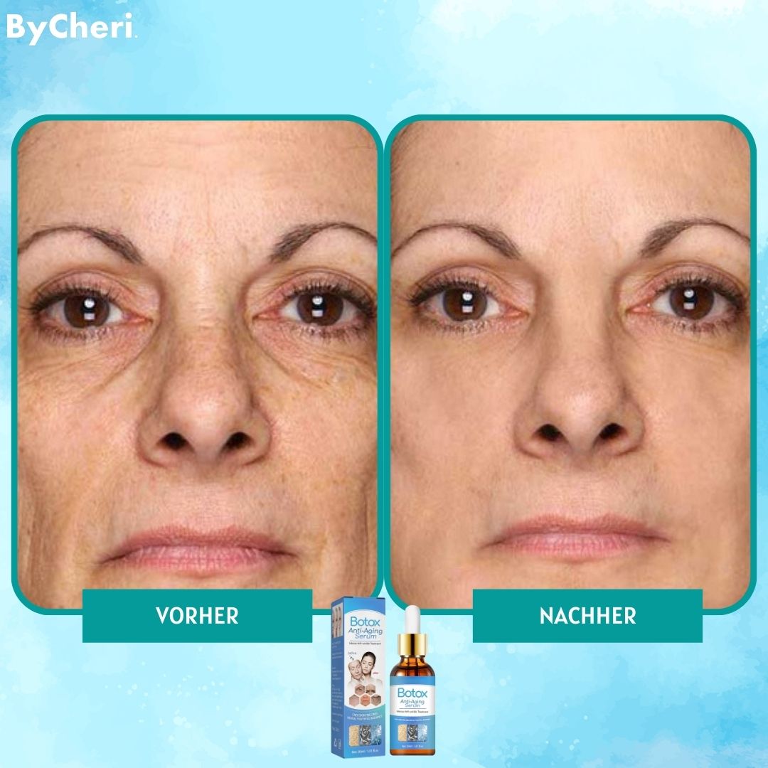 YouthGlow | Smooth Wrinkles Without Needles | 1+1 Free