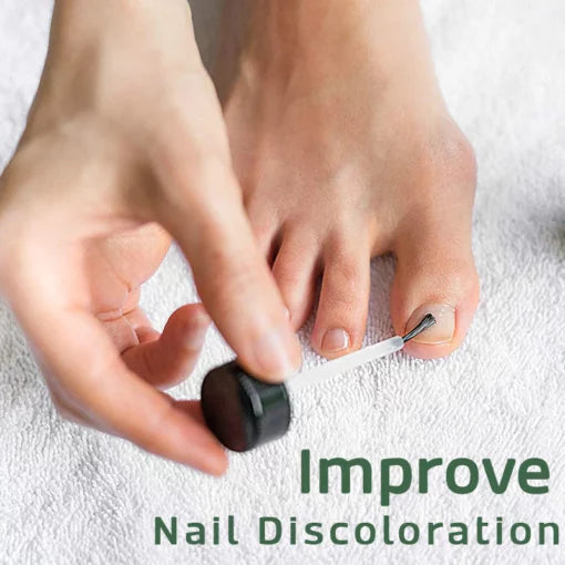 1+1 FREE | Aurelia™ Naturally Strengthen and Nourish Your Nails for Health