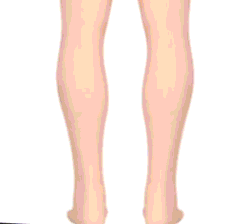 Trendy orthopedic footwear for women