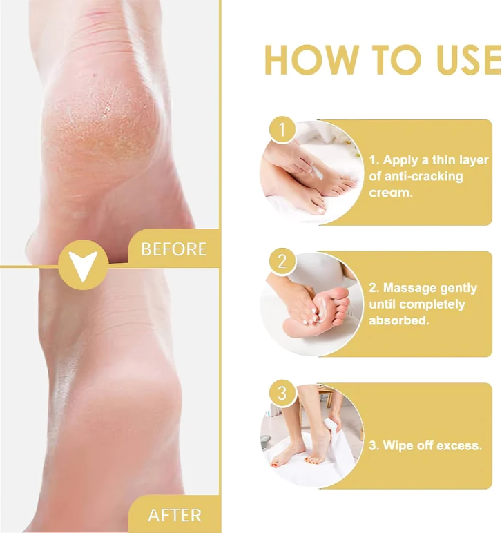 VelvetTouch™ — Heal Dry, Cracked Skin Instantly for Silky, Touchable Smoothness