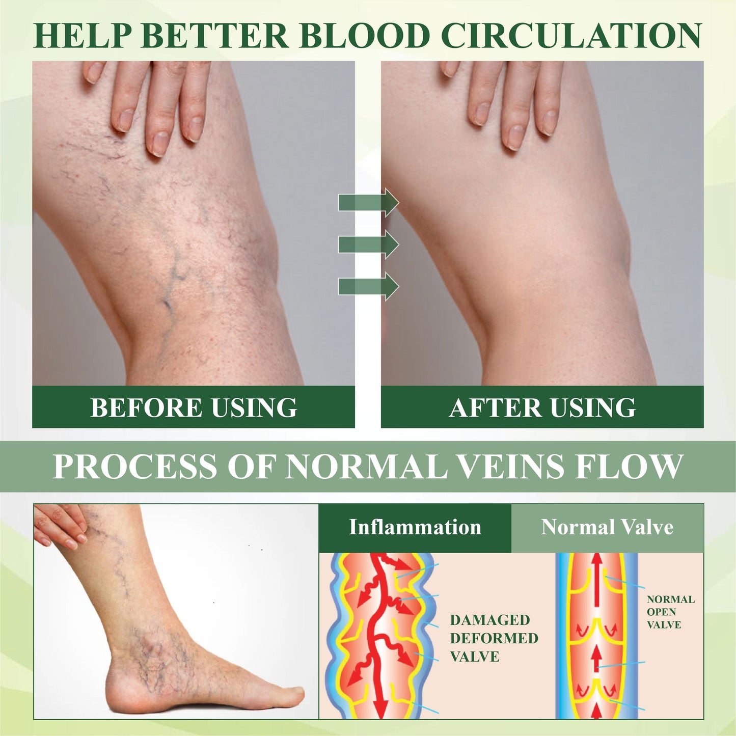 VascuRelief™ — Banish Swelling and Rediscover Effortless Freedom
