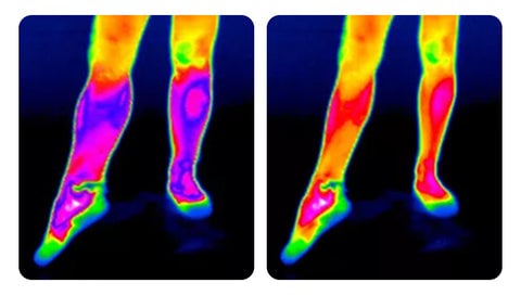 🍁AUTUMN SALE🍁 Self-Warming Knee Brace: Rapid Pain Relief