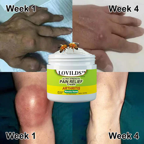BeeRelief™ — Fast Joint Pain Freedom | 50% Off