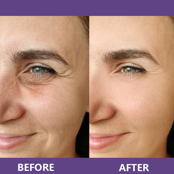 ViviLuxe™ Radiance Eye Cream — Reveal Bright, Youthful Eyes That Command Attention