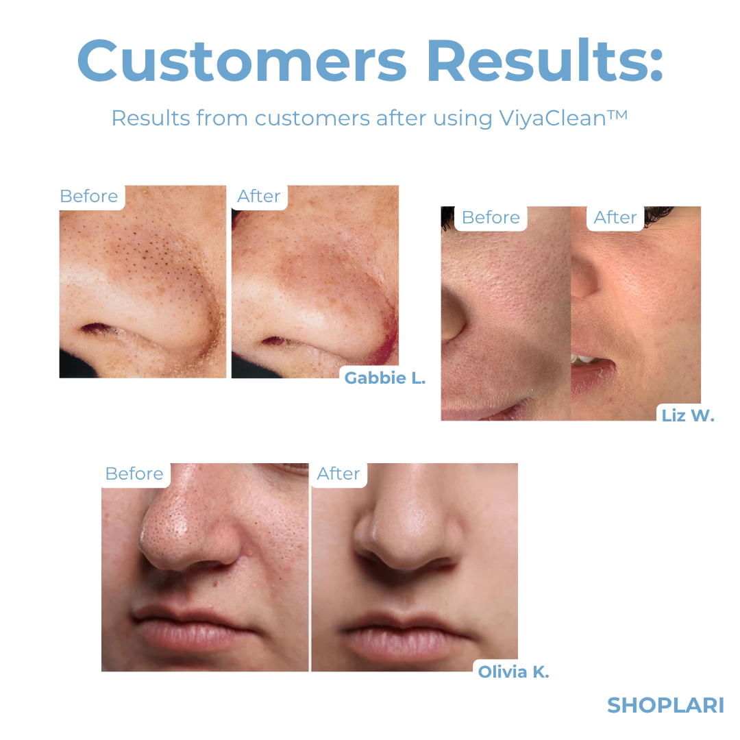 Last Day 5+5 FREE | ViyaClean™ Serum for Pore Cleansing