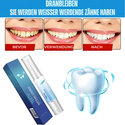 1+1 Free | OpalSmile™ – Achieve Bright White Teeth Quickly