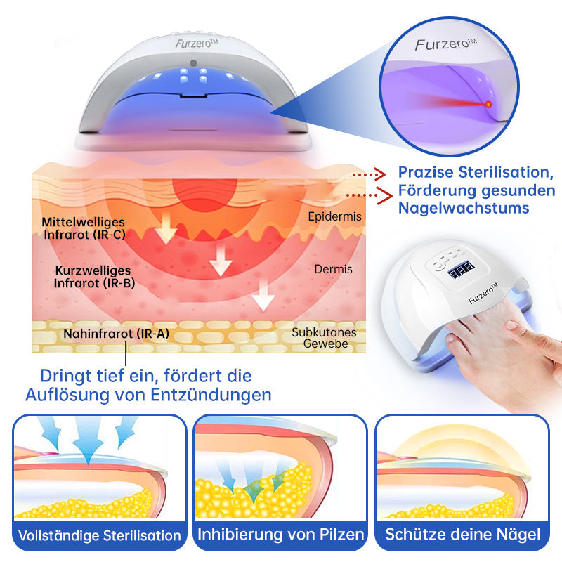 PureNail™ — Zap Nail Fungus Painlessly & Fast | 50% Off