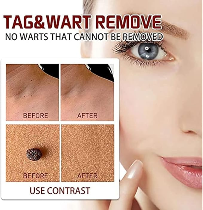 1+1 FREE | SpotWipe™ Gentle Removal