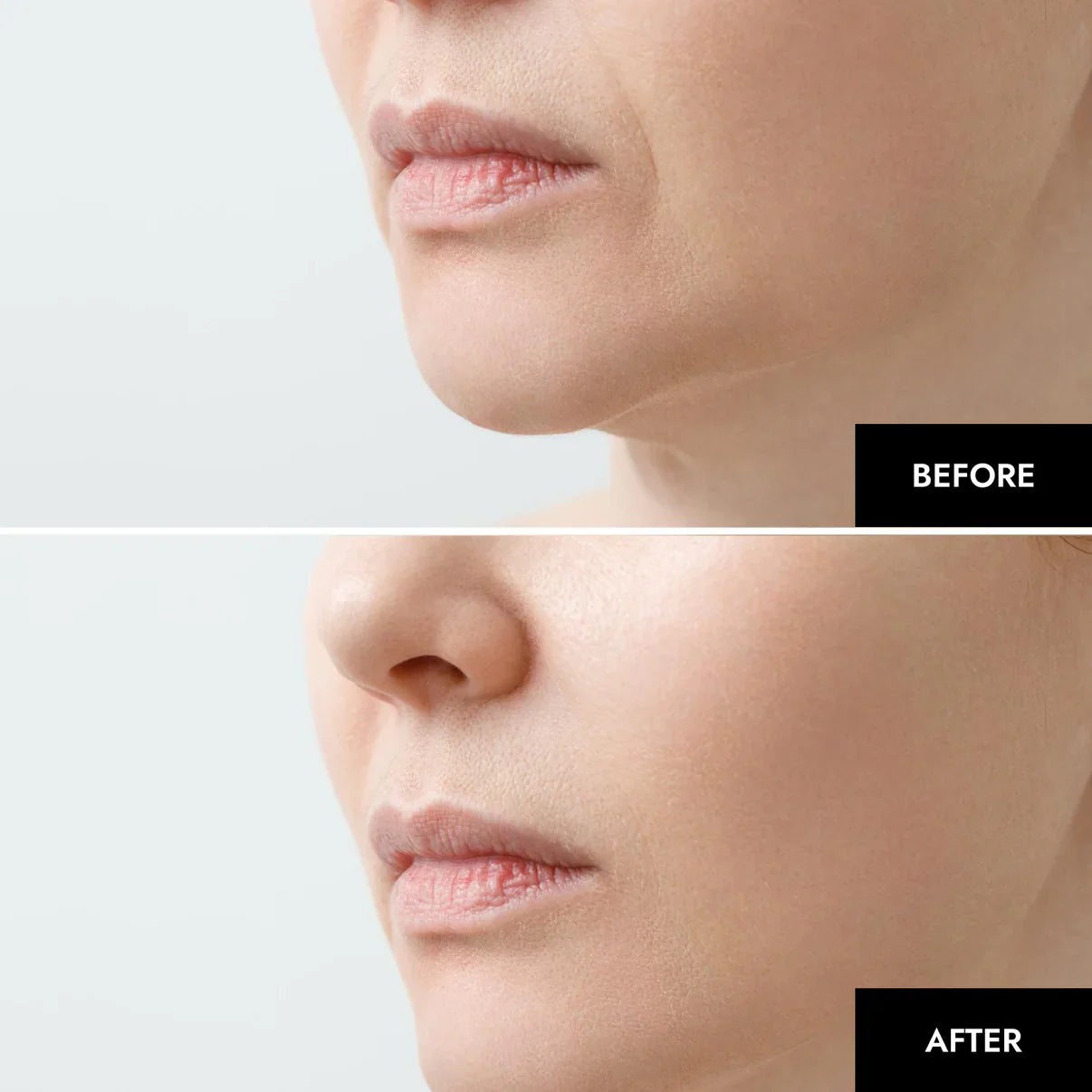 1+1 Free|NatuGlow™ – The Perfect Solution for Immediately Smoother, Radiant Skin