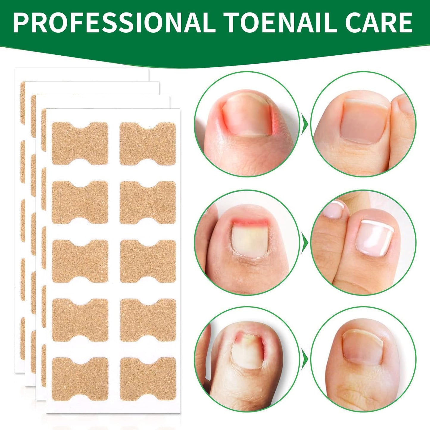 10+10 FREE | FixaNail | Instant Nail Repair