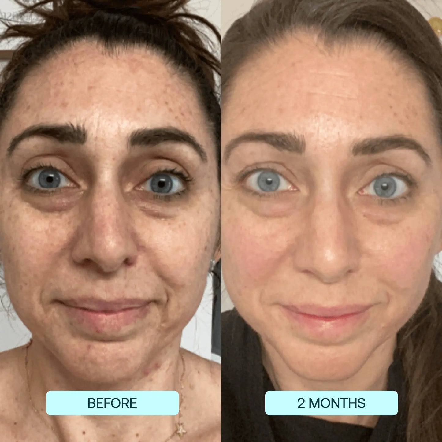 1+1 Free|NatuGlow™ – The Perfect Solution for Immediately Smoother, Radiant Skin
