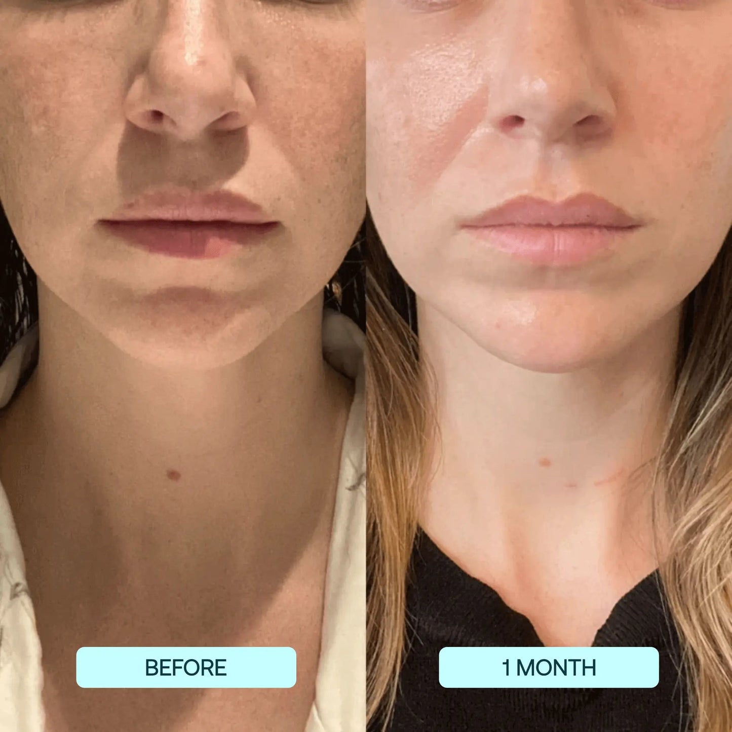 1+1 Free|NatuGlow™ – The Perfect Solution for Immediately Smoother, Radiant Skin