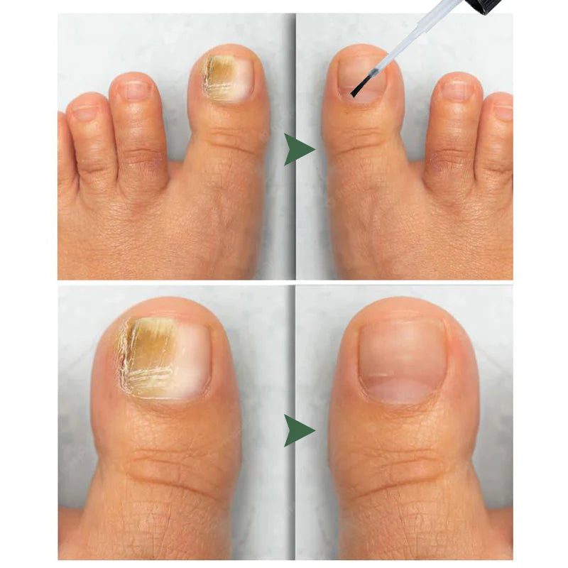 1+1 FREE | Aurelia™ Naturally Strengthen and Nourish Your Nails for Health