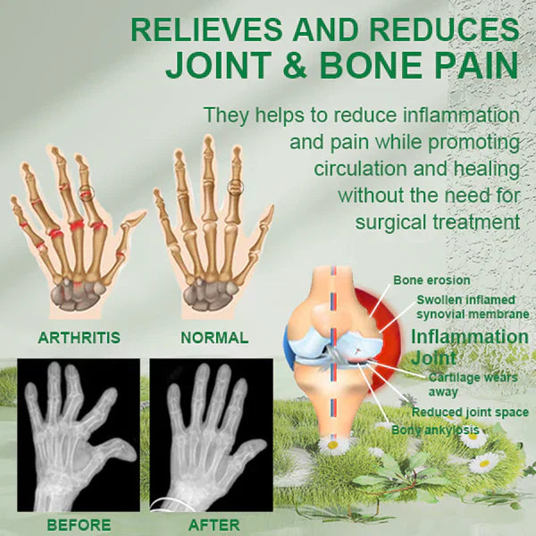 BeeRelief™ — Fast Joint Pain Freedom | 50% Off