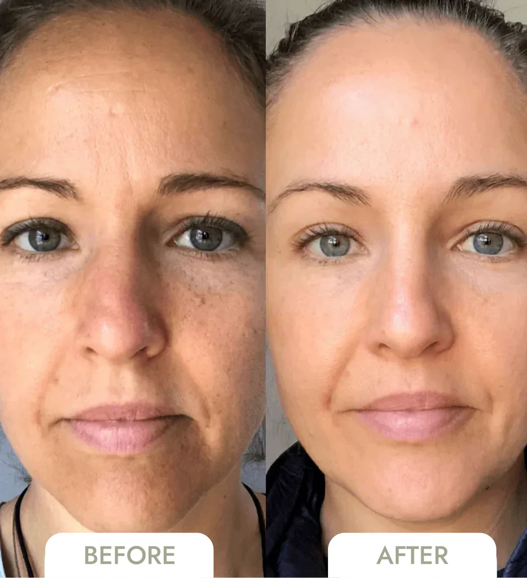 1+1 Free|NatuGlow™ – The Perfect Remedy for Instantly Smoother, Radiant Skin