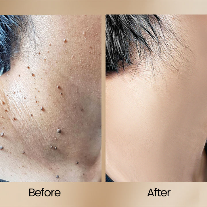 1+1 FREE | BeeClear™ Unveil Your Radiant Skin, Banish Skin Problems!