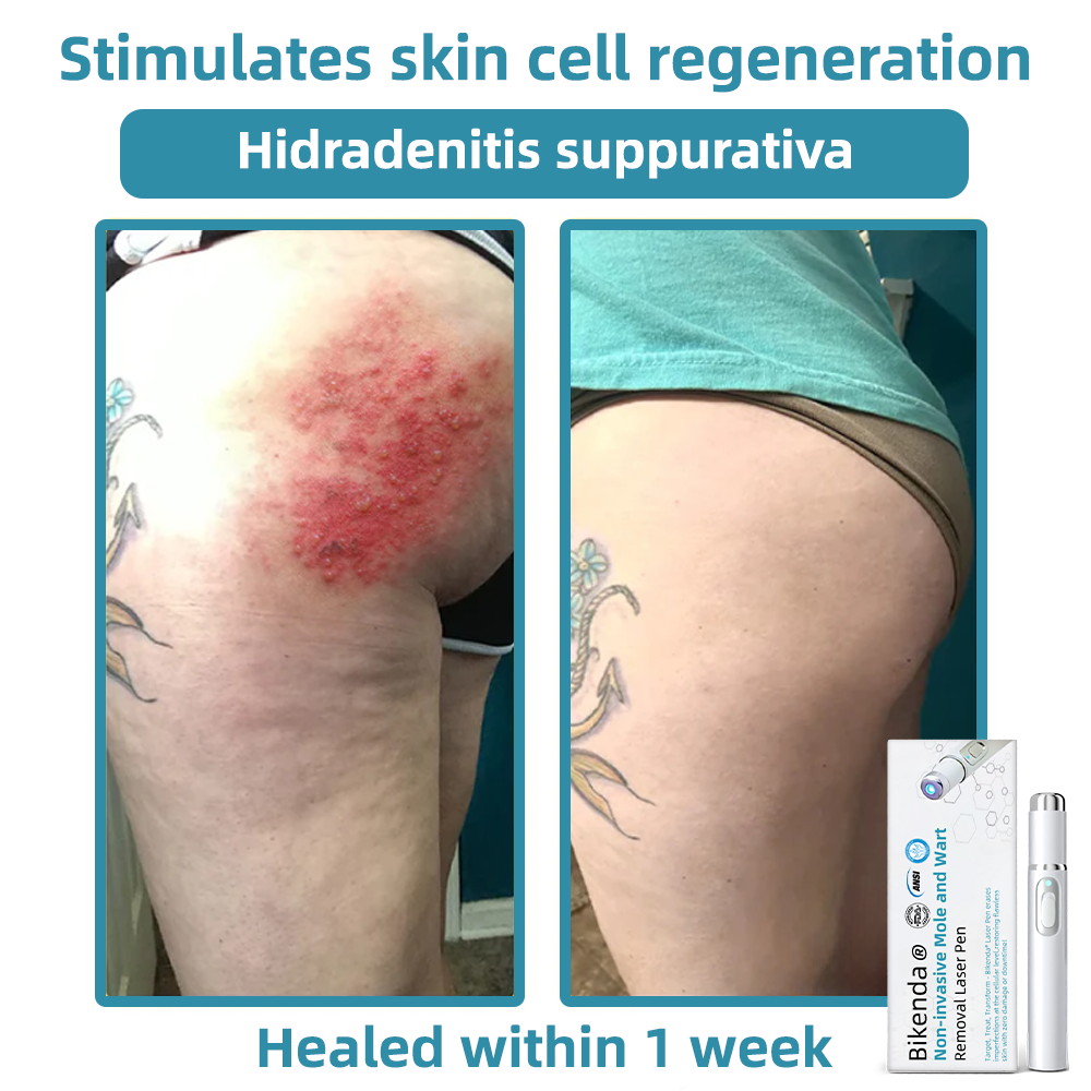LuminaraTouch™ — Effortless Laser Precision for Radiant, Flawless Skin Fast