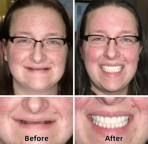 FlexDenta™ — Smile Freely Again with Dentures That Stay and Feel Real