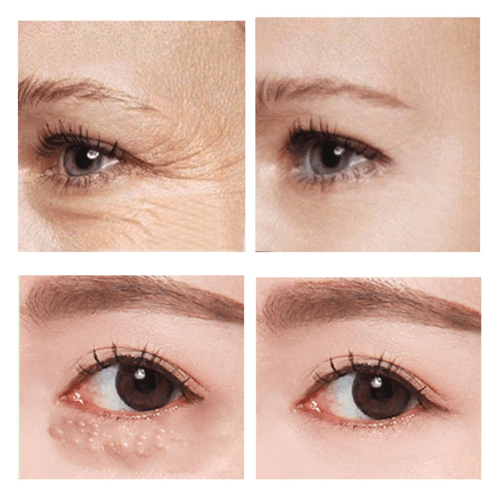 1+1 Free | SleekEyes™ Rapid-Effect Firming Eye Cream
