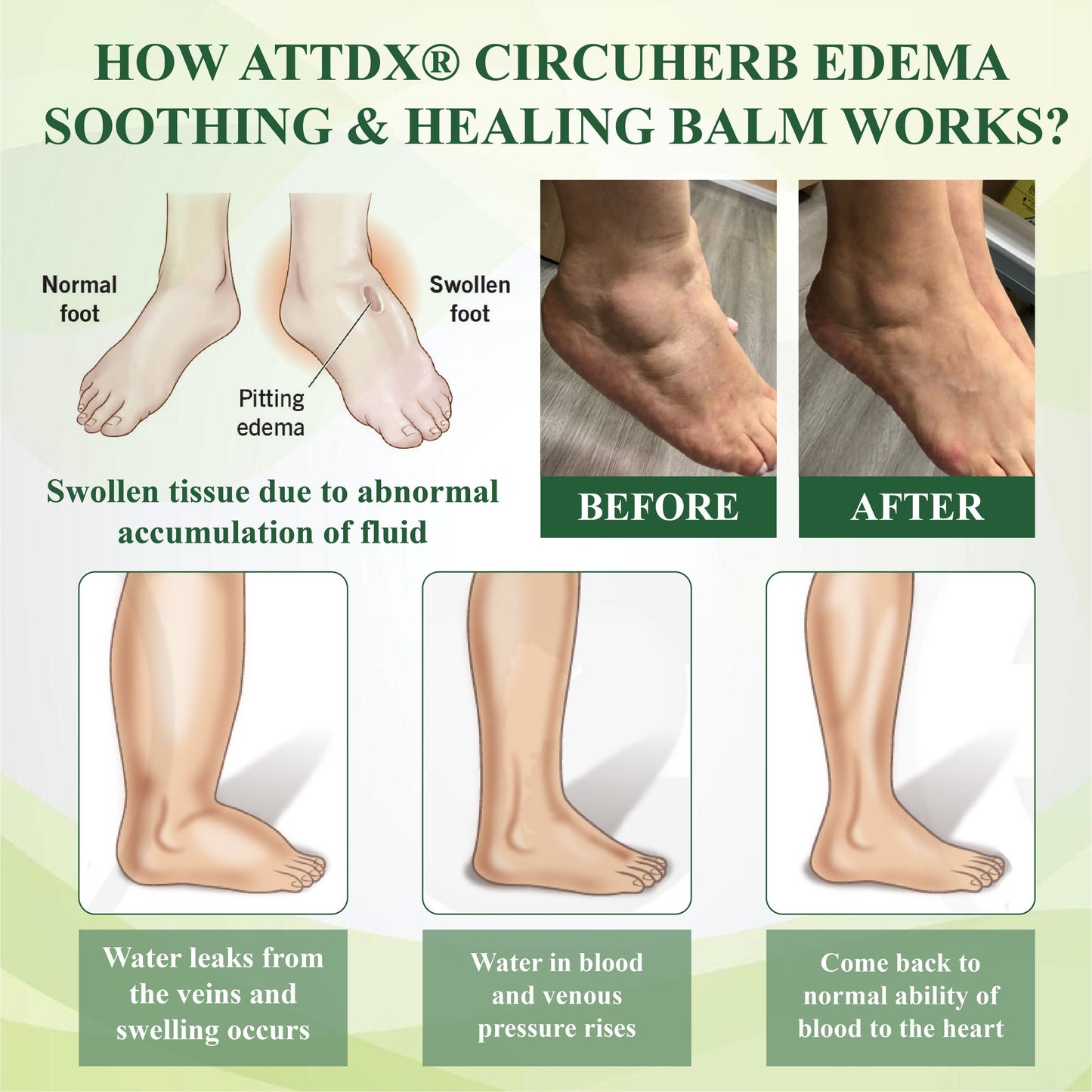 VascuRelief™ — Banish Swelling and Rediscover Effortless Freedom