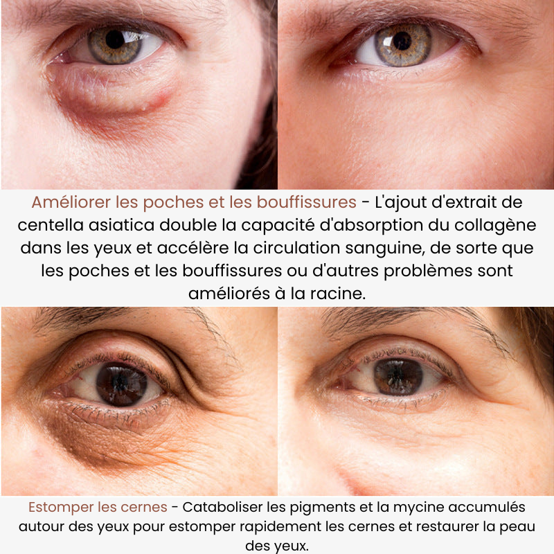 SilkEyes | Nourishes and rehydrates the skin around the eyes.
