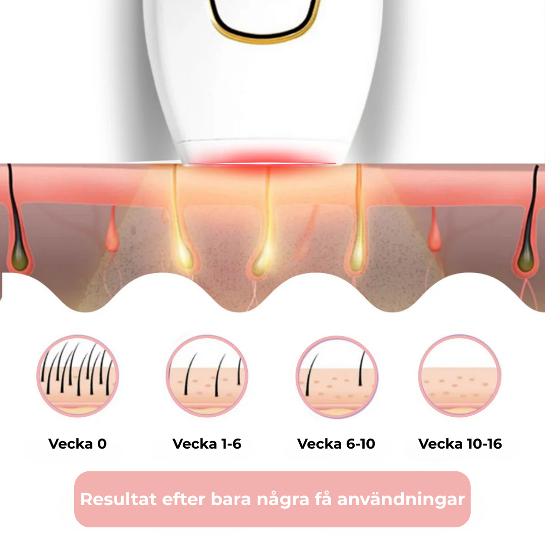 HairLess™ IPL — Effortless, Pain-Free Permanent Smoothness | 50% Off