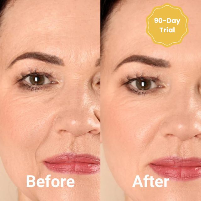 VivaLift™ Collagen Thread Kit — Lift and Renew Your Skin Instantly for a Youthful Glow