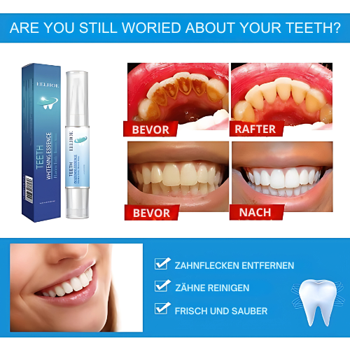 1+1 Free | OpalSmile™ – Achieve Bright White Teeth Quickly