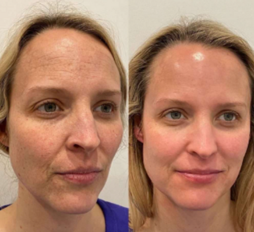 1+1 Free|NatuGlow™ – The Perfect Solution for Immediately Smoother, Radiant Skin
