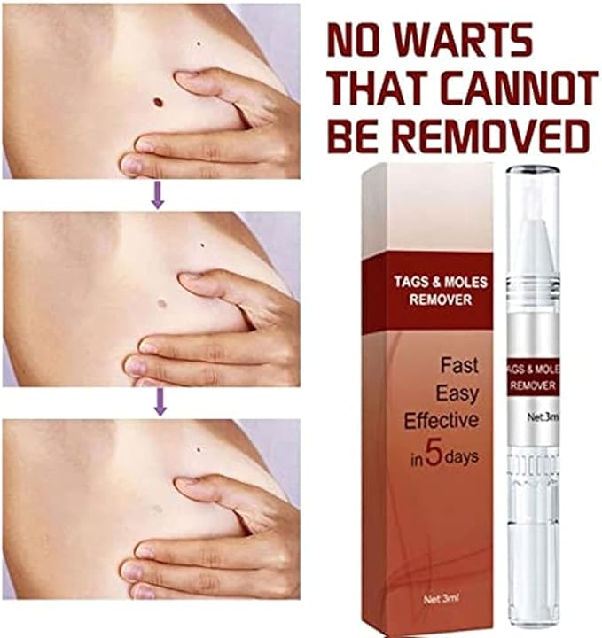1+1 FREE | SpotWipe™ Gentle Removal