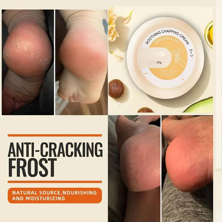 VelvetTouch™ — Heal Dry, Cracked Skin Instantly for Silky, Touchable Smoothness