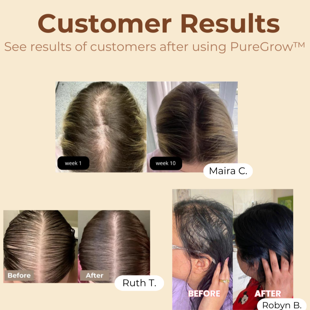 PureGrow Organic Batana Oil I Last Day 50% OFF