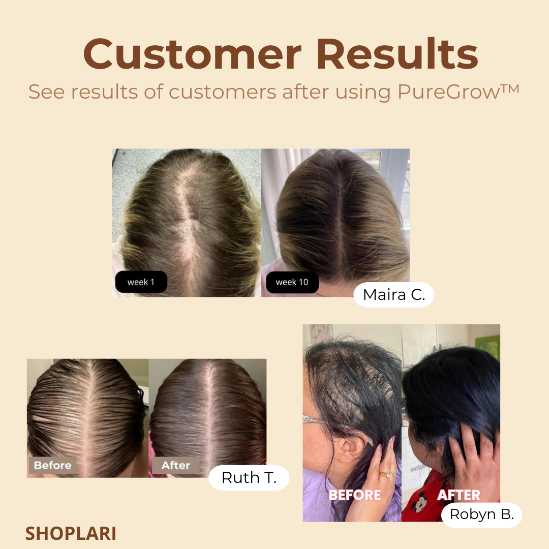 PureGrow™ — Stop Hair Loss, Grow Fuller Hair | 50% Off