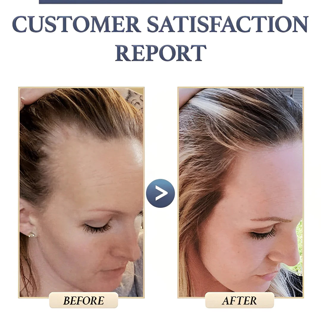 1+1 FREE | RiceGlow™ - Hair Loss Prevention (Final Day Discount)