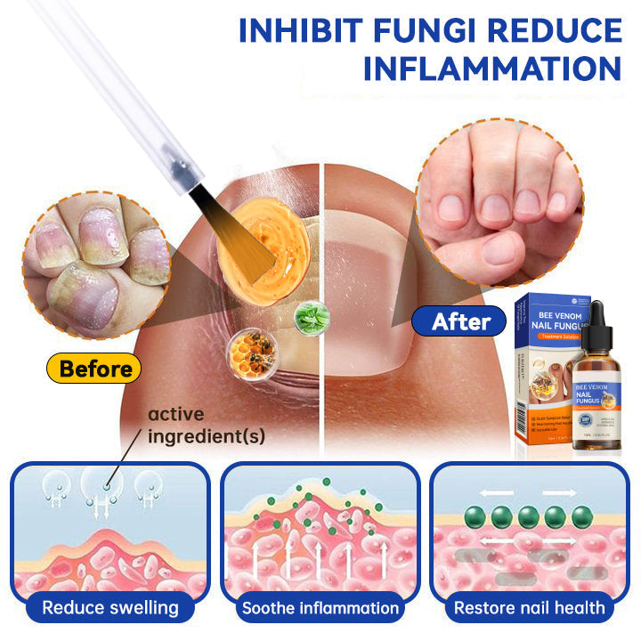 1+1 FREE | Aurelia™ Naturally Strengthen and Nourish Your Nails for Health