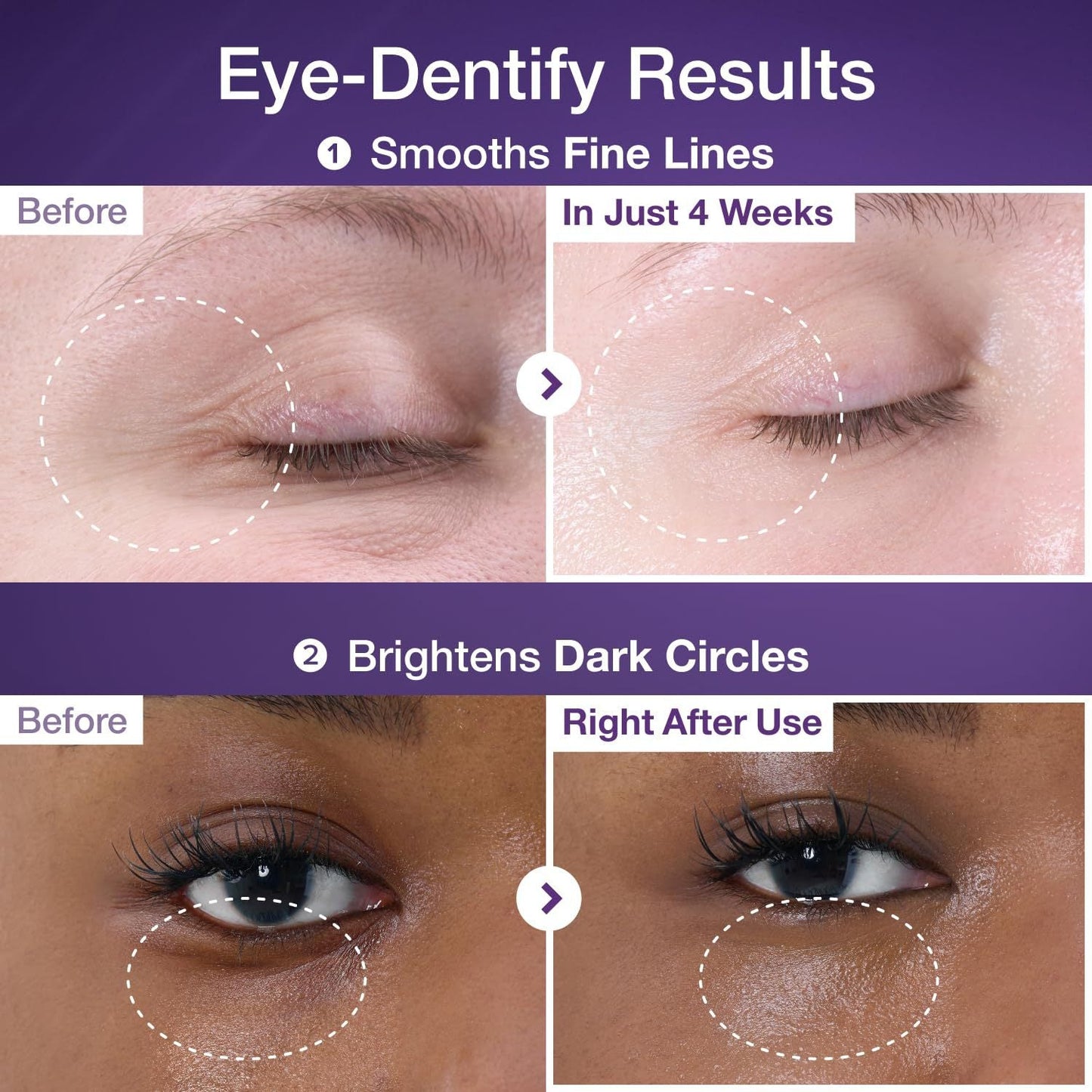 ViviLuxe™ Radiance Eye Cream — Reveal Bright, Youthful Eyes That Command Attention