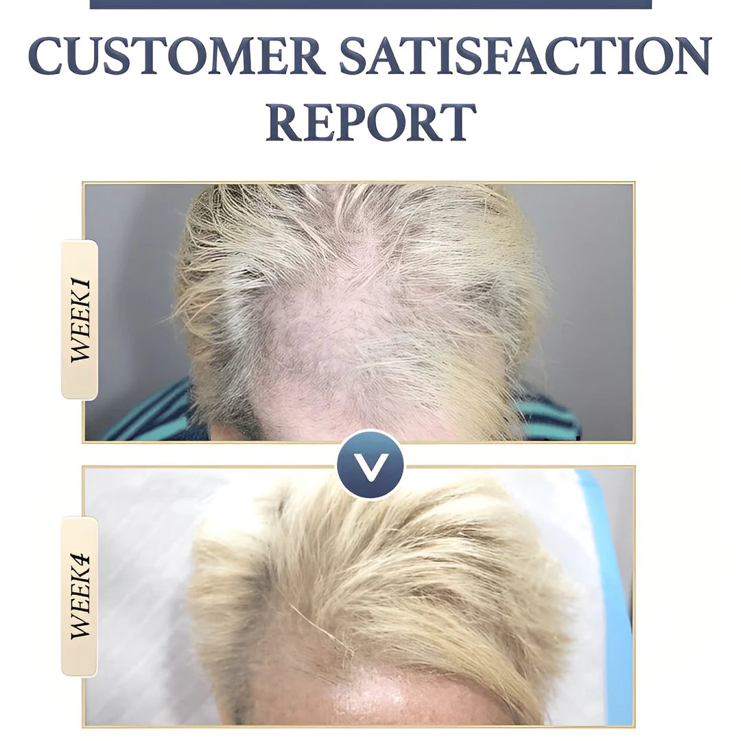 1+1 FREE | RiceGlow™ - Hair Loss Prevention (Final Day Discount)
