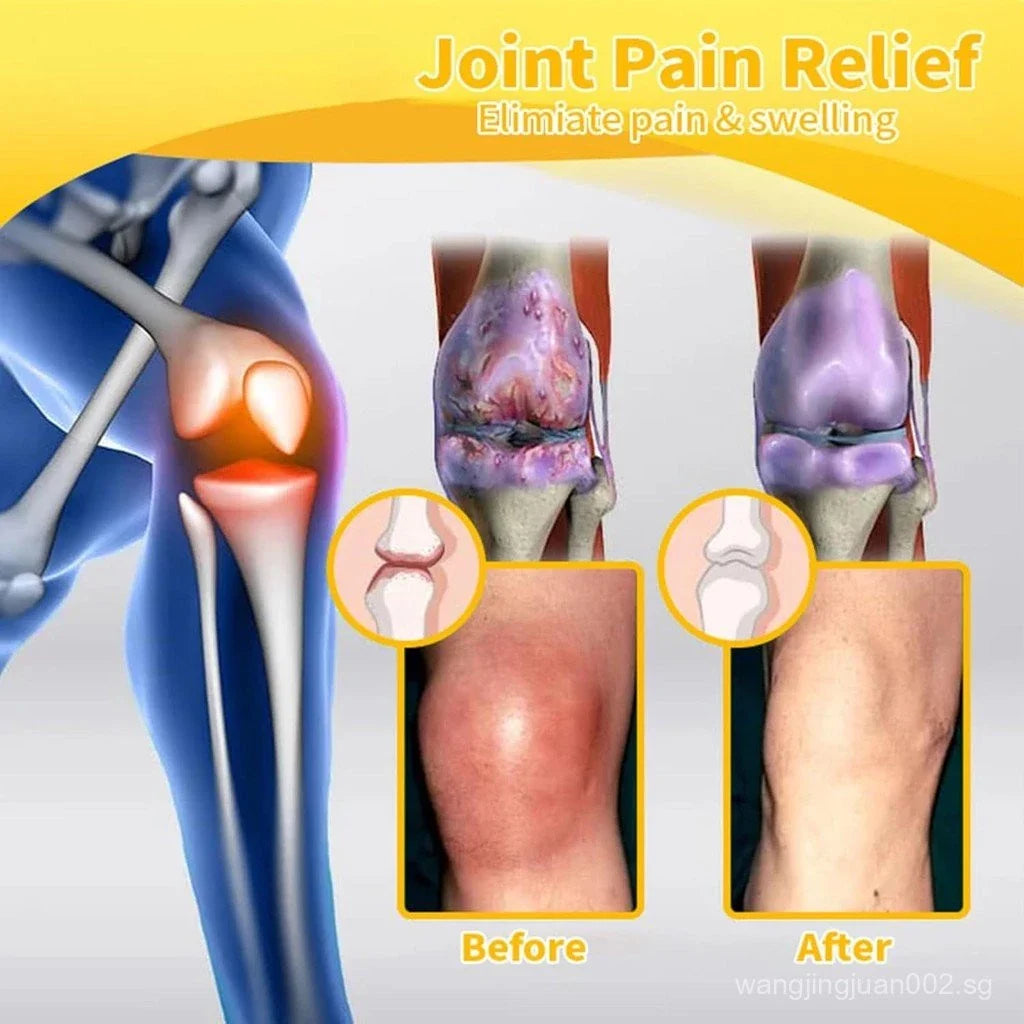 1+1 FREE | HiveRelief™ Get fast, effective relief from joint pain and inflammation!