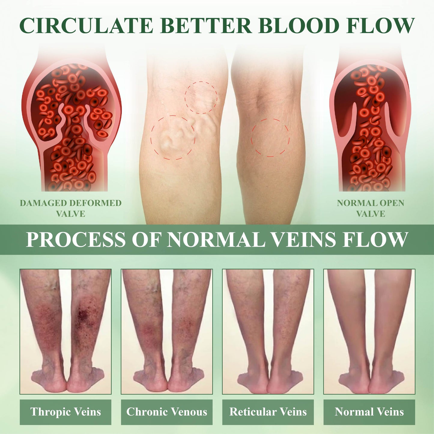 VascuRelief™ — Banish Swelling and Rediscover Effortless Freedom
