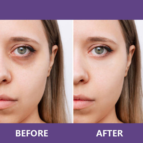 ViviLuxe™ Radiance Eye Cream — Reveal Bright, Youthful Eyes That Command Attention