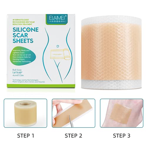 Medical Soft Silicone Gel Tape Designed for Scar Removal